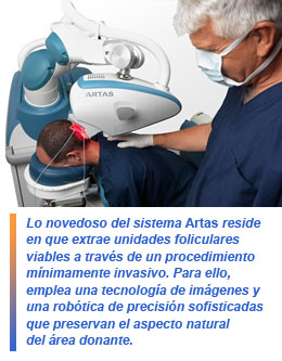Artas, tecnología robótica para trasplante capilar
