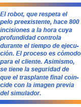Artas, tecnología robótica para trasplante capilar