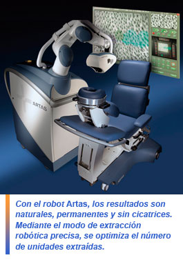 Artas, tecnología robótica para trasplante capilar
