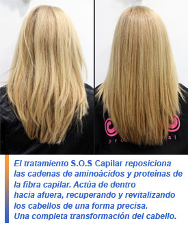 S.O.S. Capilar, tratamiento nanotecnológico antirrotura del cabello