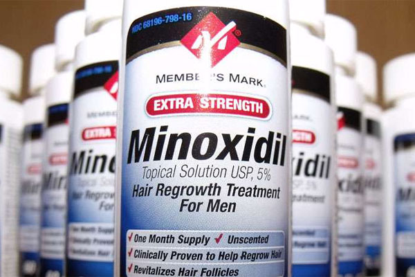 El Minoxidil, eficaz contra la alopecia androgénica